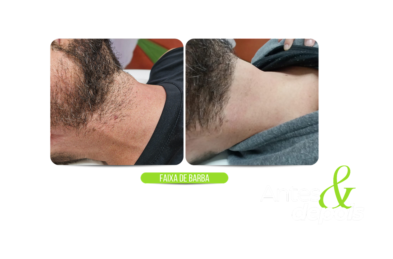 Faixa de barba - site 1